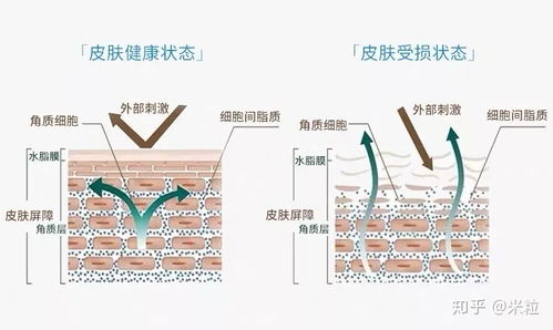 可愈类人胶原蛋白修复敷料 技术与肌肤修复的科学之道